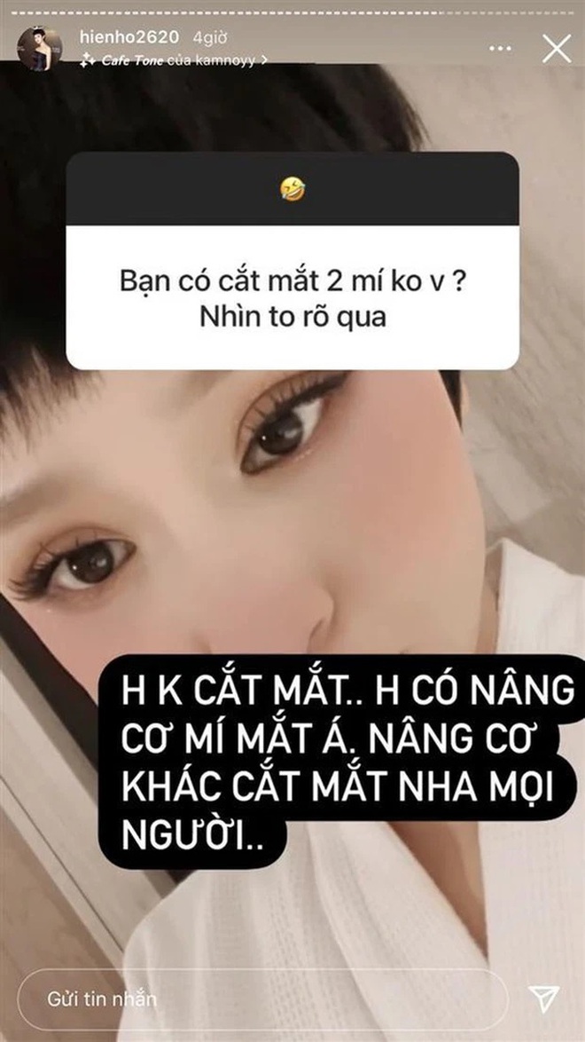 Thì ra đây là lý do Hiền Hồ cật lực tiêm filler và làm đủ c.ách để cải thiện nhan sắc? - Ảnh 2.