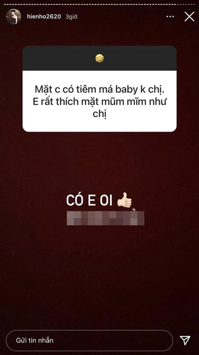 Thì ra đây là lý do Hiền Hồ cật lực tiêm filler và làm đủ c.ách để cải thiện nhan sắc? - Ảnh 2.