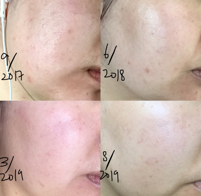 Tẩy da chết cho từng loại da: Chọn đ&uacute;ng sản phẩm cho da mới mong thắng cuộc chơi l&atilde;o h&oacute;a - Ảnh 8.
