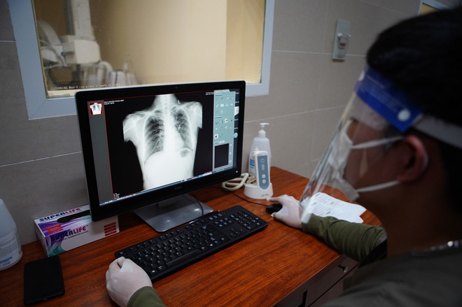 F0 khỏi bệnh đua nhau chụp Xquang xem phổi c&ograve;n đẹp: BS chỉ r&otilde; ai cần chụp, ai kh&ocirc;ng cần - Ảnh 1.