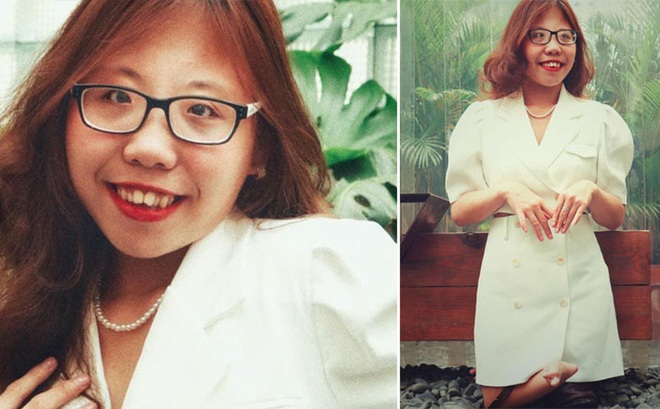 Cô gái 24 năm đi bằng đầu gối và câu chuyện nghị lực phi thường, mong 1 lần gặp lại bố mẹ - Ảnh 1.