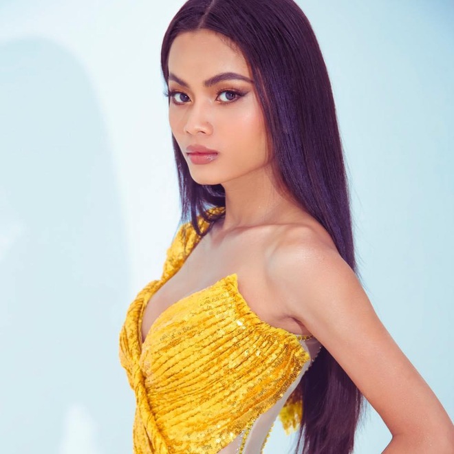 Học tr&ograve; Minh T&uacute; 2 năm 5 lần phẫu thuật, 4 lần phải mổ sọ - Ảnh 7.