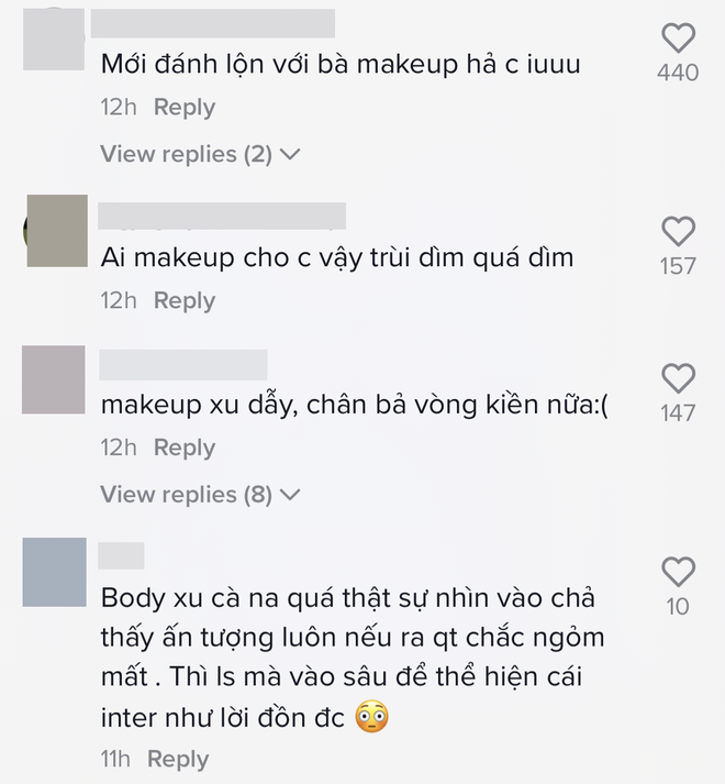 Thảo Nhi Lê bị dìm nặng khi làm vedette, nhan sắc thật dưới ống kính team qua đường ra sao? - Ảnh 2.