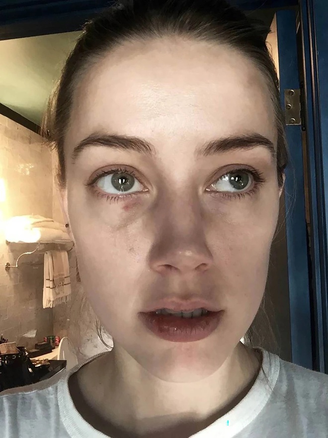 Amber Heard - Cô vợ đánh đập Johnny Depp là ai? Mỹ nhân đẹp nhất hành tinh bạo hành 2 cuộc hôn nhân, ngoại tình tay 3 với tỷ phú Twitter - Ảnh 15. Amber Heard - Cô vợ đánh đập Johnny Depp là ai? Mỹ nhân đẹp nhất hành tinh bạo hành 2 cuộc hôn nhân, ngoại tình tay 3 với tỷ phú Twitter - Ảnh 15.