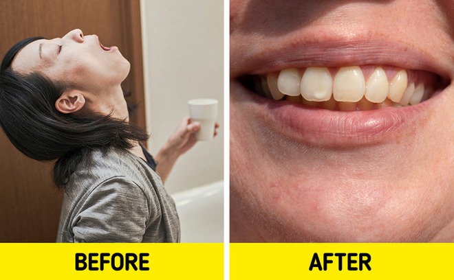 6 thói quen khiến răng của bạn dễ bị ố vàng - Ảnh 4.