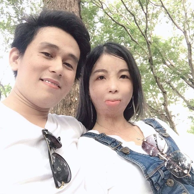 Chuyện tình cô gái bỏng 90% cơ thể và chàng shipper: Định mệnh đến từ một dòng trạng thái - Ảnh 5.