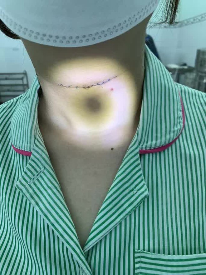 Đau họng, nuốt vướng coi chừng mắc một bệnh từ khi c&ograve;n l&agrave; b&agrave;o thai - Ảnh 2.