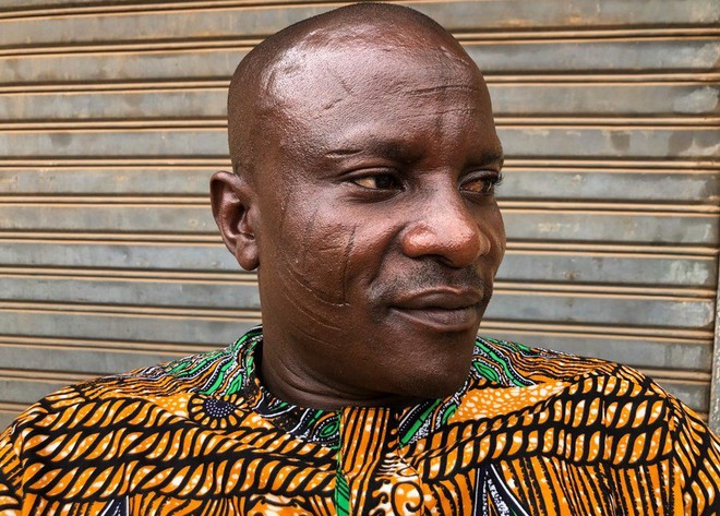 Tập tục rạch mặt tại Nigeria: Khi những vết sẹo trên mặt xác định danh tính và vẻ đẹp của một người - Ảnh 2.