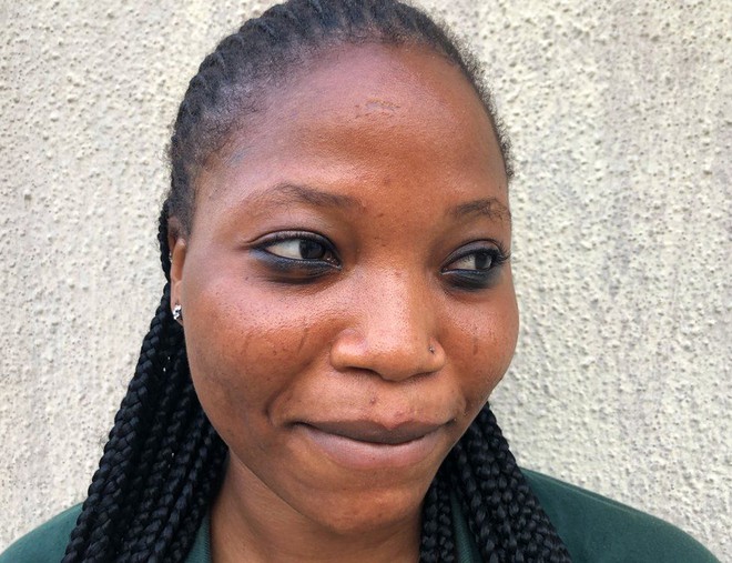 Tập tục rạch mặt tại Nigeria: Khi những vết sẹo trên mặt xác định danh tính và vẻ đẹp của một người - Ảnh 4.