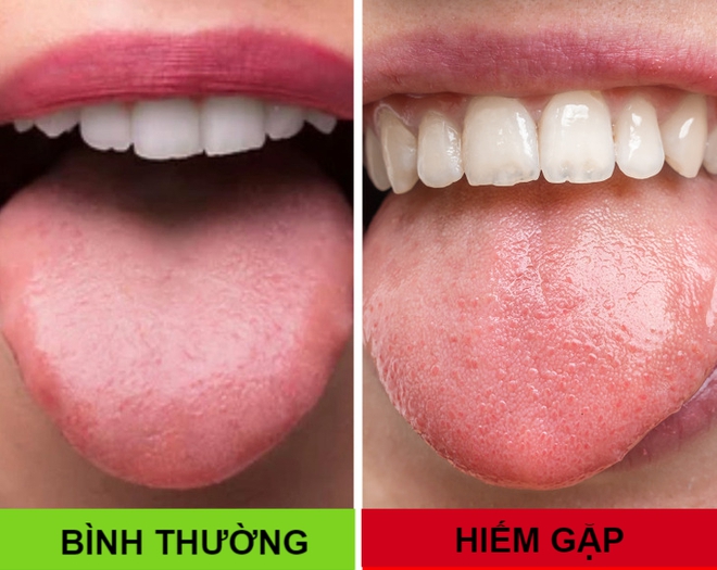 Nếu sở hữu 1 trong 8 đặc điểm này, bạn sẽ thuộc nhóm người đặc biệt nhất trên thế giới - Ảnh 4.