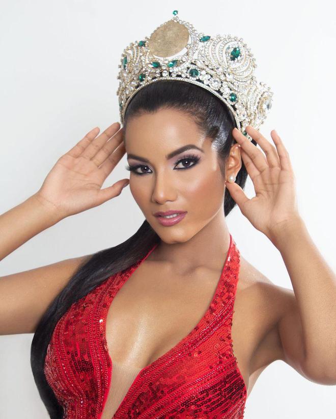 T&acirc;n Hoa hậu Si&ecirc;u quốc gia Venezuela lộ diện: Body cực sexy nhưng gương mặt bị ch&ecirc; gi&agrave; trước tuổi - Ảnh 1.