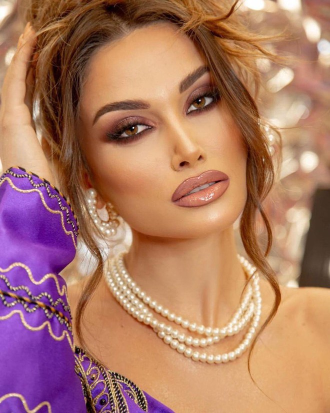 Nhan sắc nóng bỏng tựa thiên thần nội y của tân Hoa hậu Trái đất Albania 2022 - Ảnh 2.