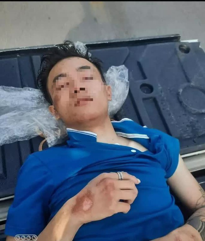 Nam thanh ni&ecirc;n được ph&aacute;t hiện trong t&igrave;nh trạng dập n&atilde;o ở nghĩa trang - Ảnh 1.