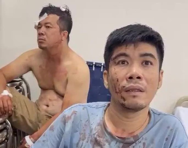 Tạm giữ 8 người trong vụ &aacute;n mạng đau l&ograve;ng tại quận 11, TP.HCM - Ảnh 1.