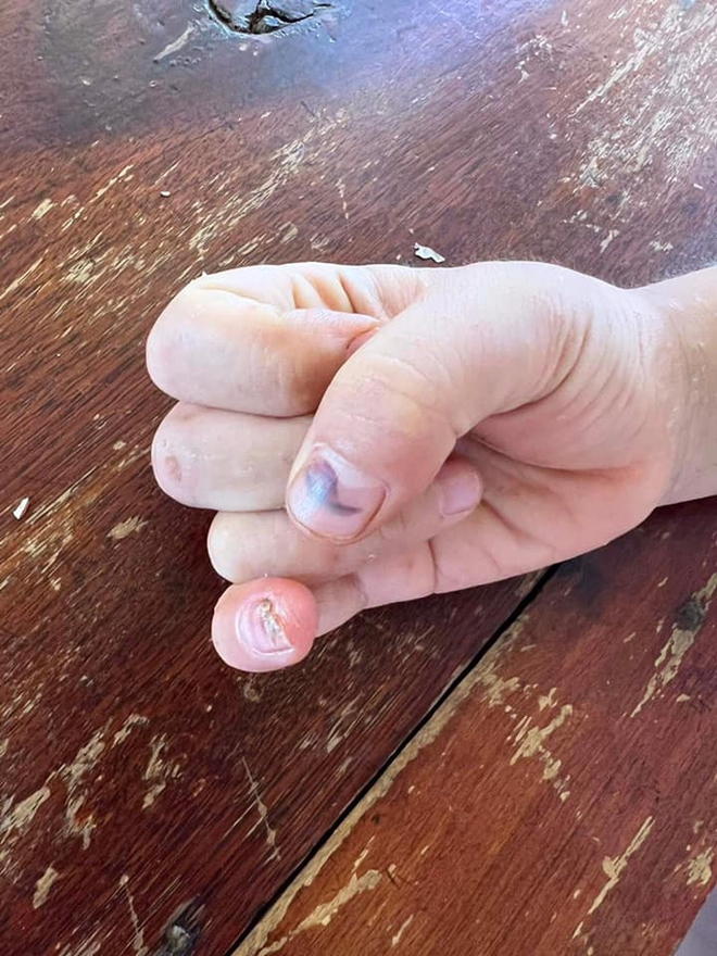 Khởi tố cha v&agrave; b&agrave; nội đ&aacute;nh đập d&atilde; man ch&aacute;u b&eacute; 9 tuổi - Ảnh 3.