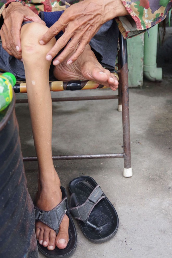 Người đàn ông bị liệt vẫn miệt mài làm shipper ở Sài Gòn: Tôi không muốn vừa tàn vừa phế - Ảnh 2.