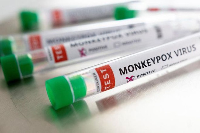&ldquo;S&aacute;t thủ thầm lặng&rdquo; đậu m&ugrave;a khỉ, th&ecirc;m ca tử vong ngo&agrave;i ch&acirc;u Phi - Ảnh 1.