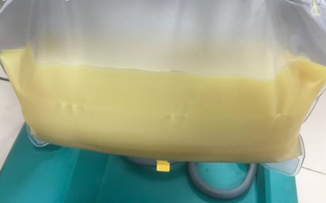 Cứu sống bệnh nh&acirc;n c&oacute; huyết tương trắng đục như sữa - Ảnh 1.