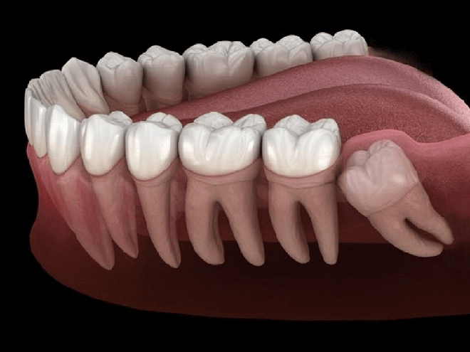 Câu đố Tiếng Việt: Thứ gì rõ khôn, nhưng ai cũng ghét? - Ảnh 2.