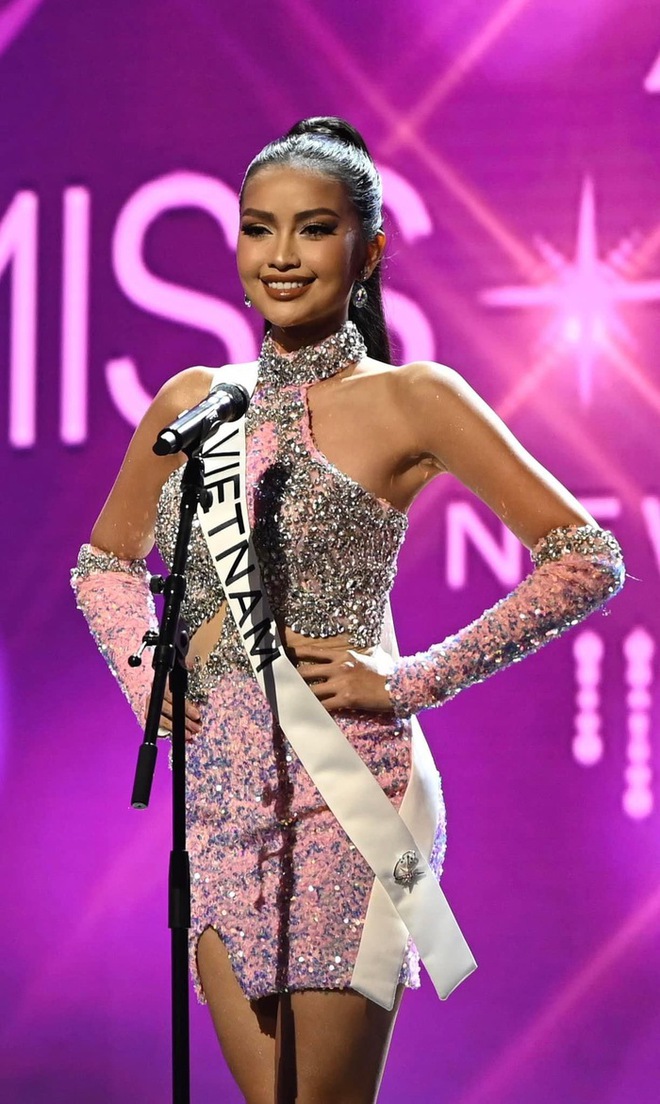 Ngọc Ch&acirc;u lộ đ&ocirc;i ch&acirc;n bầm t&iacute;m ở Miss Universe 2022 - Ảnh 4.