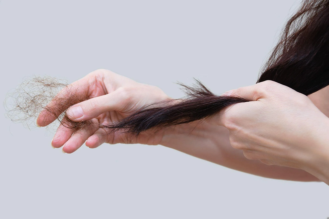 Mùa thu, tóc rụng nhiều gấp 4 lần: Đây là cách để chị em khắc phục vấn đề - Ảnh 1.