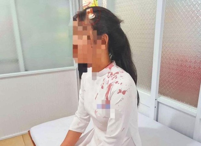 Diễn biến mới vụ nữ sinh đ&aacute;nh bạn đổ m&aacute;u - Ảnh 1.