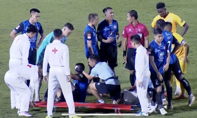 2 cầu thủ phải nhập viện trong trận thắng gi&uacute;p CLB TP.HCM dẫn đầu V-League - Ảnh 3.