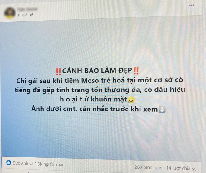 Tưởng tiêm meso căng bóng da, có người đau đớn nhận lại khuôn mặt rỗ như tổ ong, ai nhìn cũng phải xót xa - Ảnh 1.