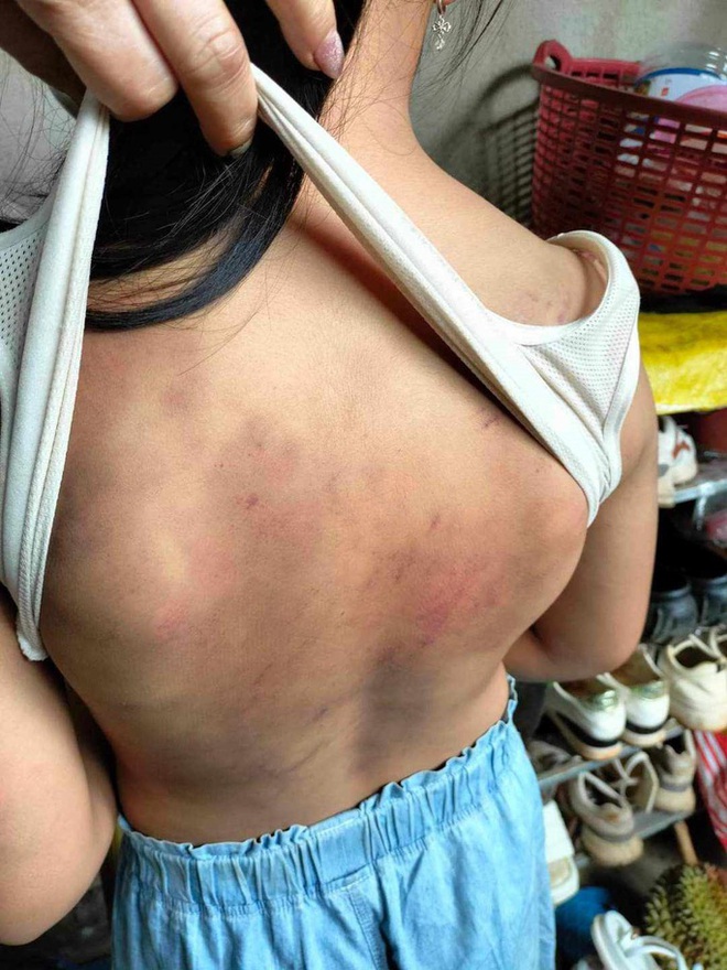 Mười học sinh lớp 4 đ&aacute;nh bạn d&atilde; man - Ảnh 1.