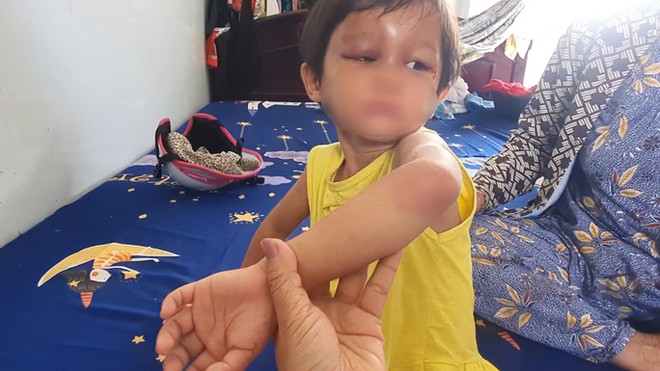 Diễn biến mới vụ b&eacute; g&aacute;i 4 tuổi bị cha nu&ocirc;i đ&aacute;nh đập d&atilde; man - Ảnh 1.