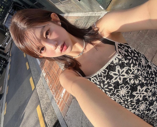 Cựu idol Kpop chia sẻ bí quyết trị mụn thâm, hé lộ một sự thật ít ai biết về làn da "mộc" của các ngôi sao Hàn - Ảnh 3.