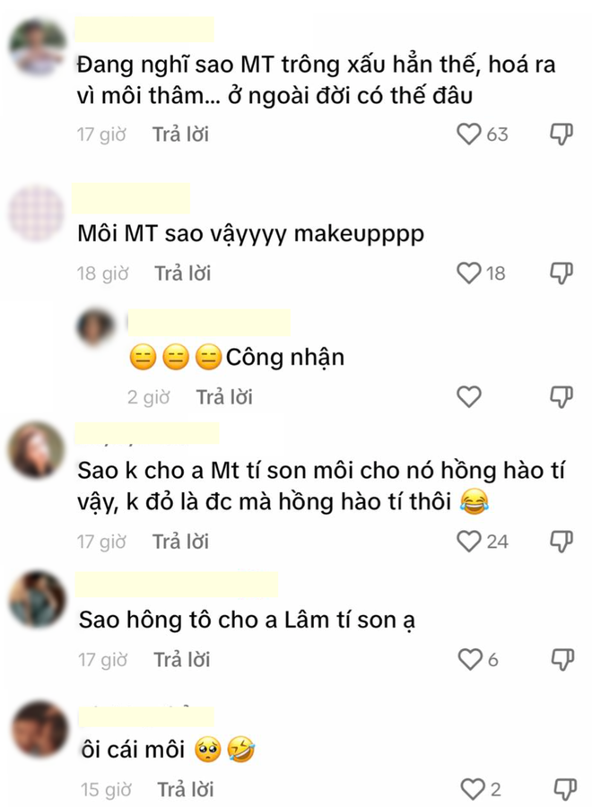 Mỹ nam phim Việt giờ v&agrave;ng bất ngờ bị ch&ecirc; nhan sắc chỉ v&igrave; một đặc điểm, netizen thấy m&agrave; bất b&igrave;nh thay - Ảnh 4.