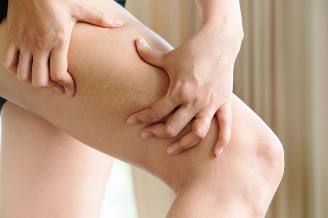 4 bộ phận n&agrave;y tr&ecirc;n cơ thể nữ giới c&agrave;ng xấu th&igrave; bạn c&agrave;ng khỏe mạnh! - Ảnh 2.