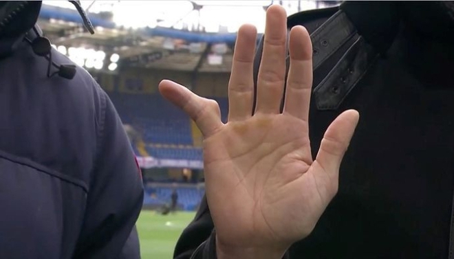 Sau khi chơi gần 700 trận, cựu thủ môn gây ngỡ ngàng khi tiết lộ hình ảnh ngón tay út - Ảnh 2.