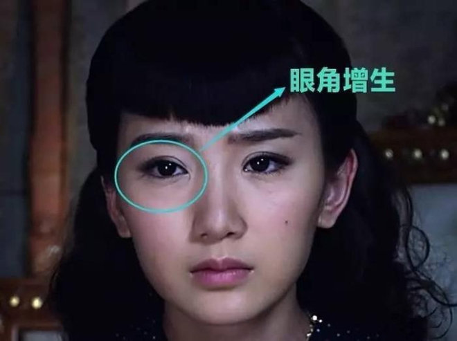 Một sao nữ xinh như tiên tử ở sự kiện, nhưng netizen chỉ đổ xô zoom cận 1 chi tiết bất thường trên gương mặt - Ảnh 6.