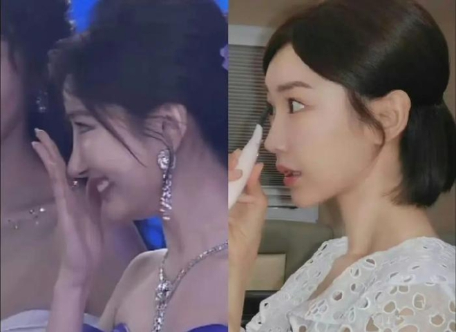 Một sao nữ xinh như tiên tử ở sự kiện, nhưng netizen chỉ đổ xô zoom cận 1 chi tiết bất thường trên gương mặt - Ảnh 3.