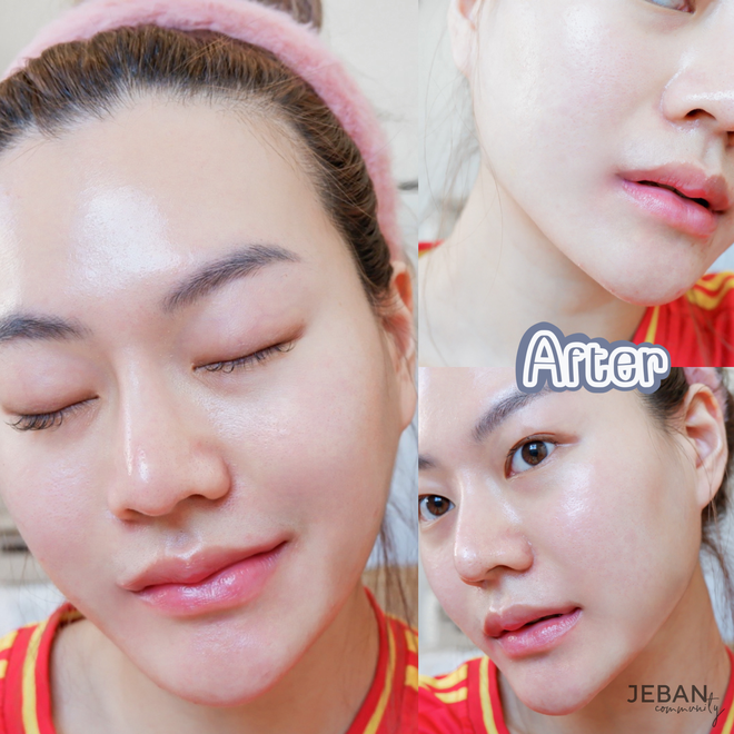 2 th&aacute;ng d&ugrave;ng thử chai serum chống l&atilde;o h&oacute;a đắt xắt ra miếng, l&agrave;n da của n&agrave;ng blogger thay đổi đ&aacute;ng kinh ngạc - Ảnh 5.