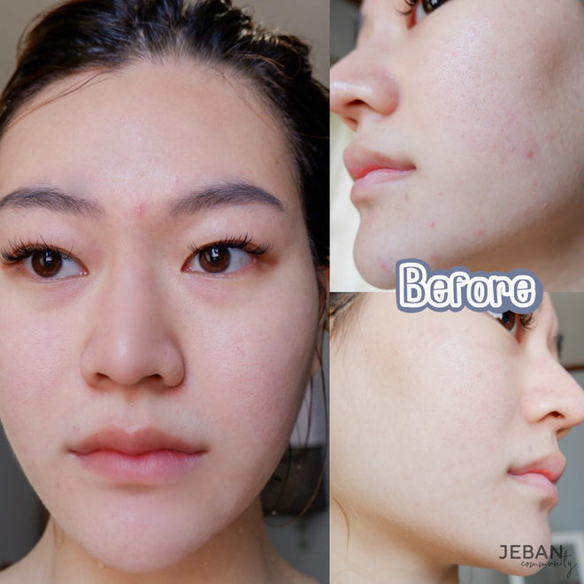2 th&aacute;ng d&ugrave;ng thử chai serum chống l&atilde;o h&oacute;a đắt xắt ra miếng, l&agrave;n da của n&agrave;ng blogger thay đổi đ&aacute;ng kinh ngạc - Ảnh 4.