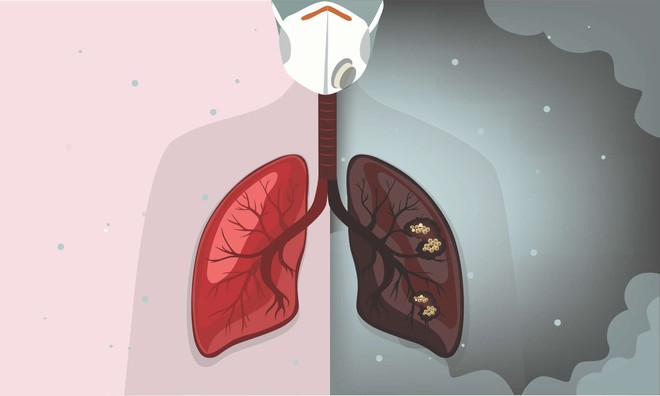 Cơ quan phổi sợ nhất 3 thứ nhưng đáng tiếc nhiều người lại hay mắc phải, sửa ngay từ cái đầu tiên đã giúp tăng tuổi thọ - Ảnh 1.