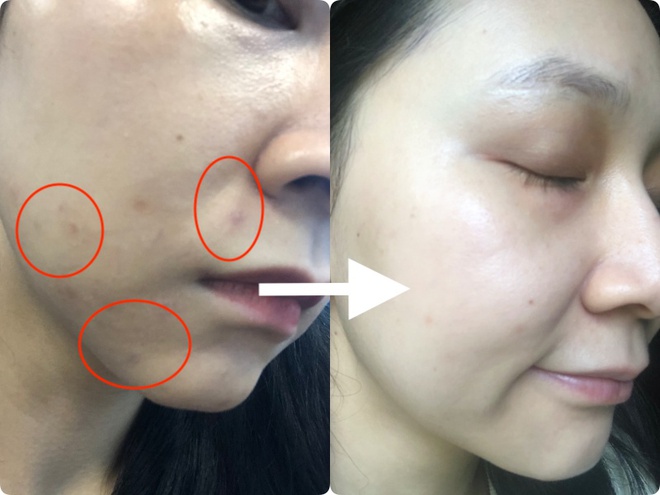 Dùng thử dầu dưỡng da giá 150k mà beauty blogger Trinh Phạm gợi ý: Lên da mịn mướt, vết thâm mờ hẳn sau vài ngày - Ảnh 5.