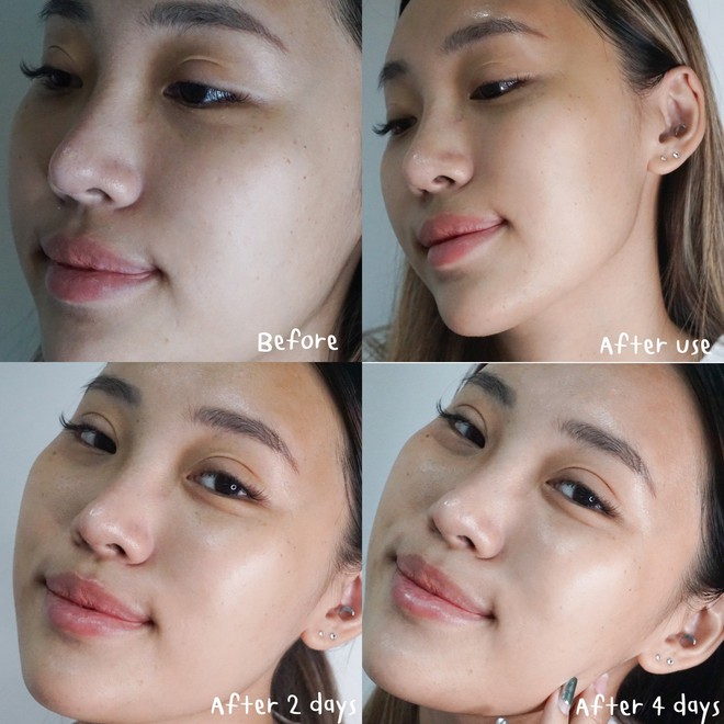 D&ugrave;ng thử m&aacute;y đắp mặt nạ gi&aacute; 5 triệu, 4 c&ocirc; n&agrave;ng đưa ra nhận x&eacute;t về việc c&oacute; n&ecirc;n mua hay kh&ocirc;ng - Ảnh 6.