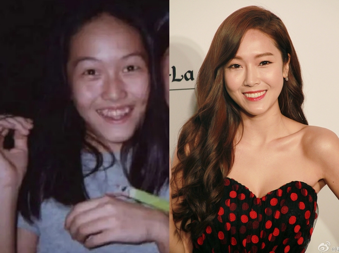 Song Hye Kyo, L&acirc;m T&acirc;m Như... thăng hạng nhan sắc nhờ niềng răng - Ảnh 10.