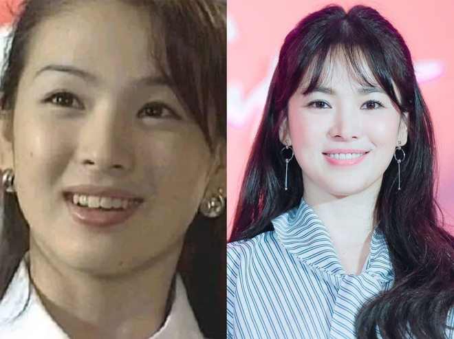 Song Hye Kyo, Lâm Tâm Như... thăng hạng nhan sắc nhờ niềng răng - Ảnh 1.