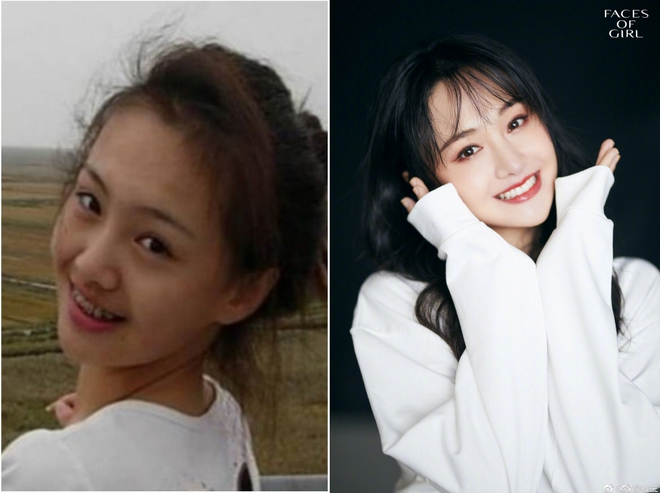 Song Hye Kyo, L&acirc;m T&acirc;m Như... thăng hạng nhan sắc nhờ niềng răng - Ảnh 8.