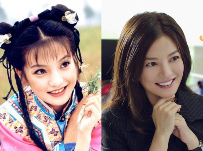 Song Hye Kyo, L&acirc;m T&acirc;m Như... thăng hạng nhan sắc nhờ niềng răng - Ảnh 3.