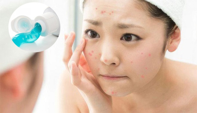 5 th&agrave;nh phần chăm s&oacute;c da tự chế cần tr&aacute;nh - Ảnh 5.