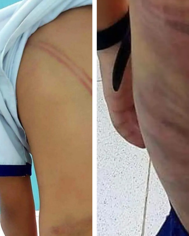 Chủ tịch tỉnh C&agrave; Mau chỉ đạo xử l&yacute; nghi&ecirc;m vụ mẹ kế bạo h&agrave;nh con ri&ecirc;ng của chồng - Ảnh 1.