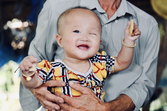 Lời khẩn cầu của &ocirc;ng nội xin cứu b&eacute; g&aacute;i 14 th&aacute;ng tuổi phải bỏ một b&ecirc;n mắt v&igrave; ung thư - Ảnh 8.