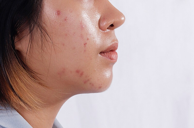 V&igrave; sao ch&uacute;ng ta lại gi&agrave; nhanh hơn c&aacute;c b&agrave; c&aacute;c mẹ ng&agrave;y trước? - Ảnh 3.