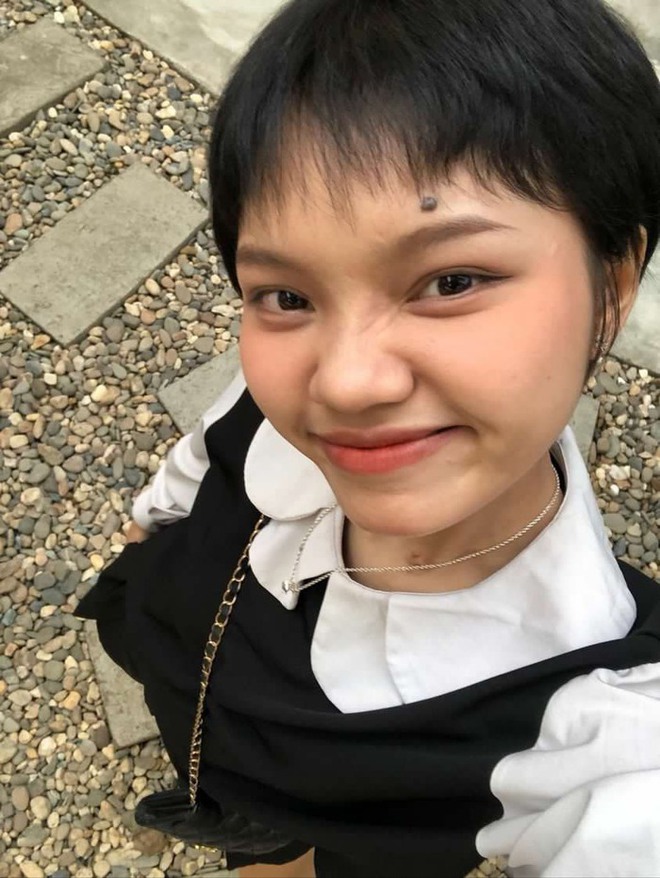 Mắc ung thư m&aacute;u ở tuổi 18, ti&ecirc;n lượng kh&oacute; qua khỏi, c&ocirc; g&aacute;i vẫn quyết t&acirc;m gi&agrave;nh lấy sự sống - Ảnh 2.